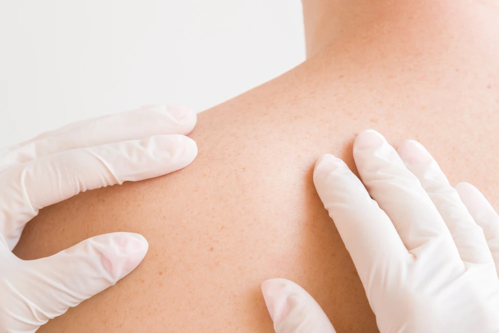 skin-exam.webp